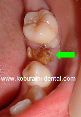 �^�[�i�[��